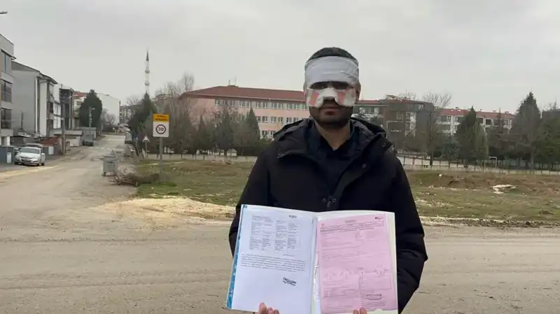 Öğretmen Tartışması Büyüdü: Yüzüne Sıcak Çay Fırlatan Olayın Ardındaki Gerçekler